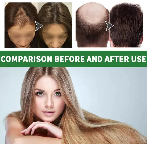 Rosemary Essential hair grow Oil